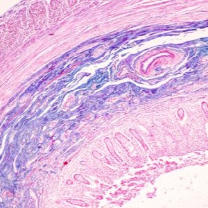 Key role found for gut epithelial cells and their expression of MHCII in the defense against deadly infections